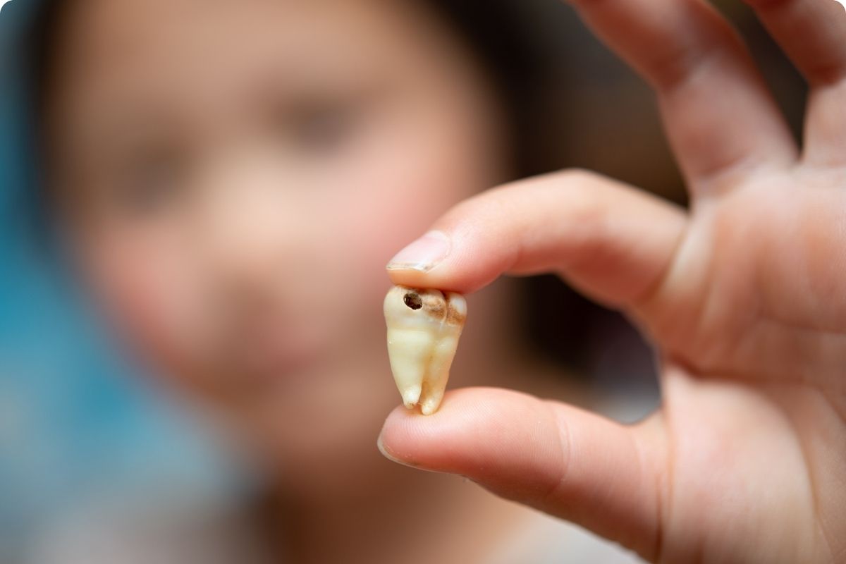 Misconceptions about Children Dental Clinic SG